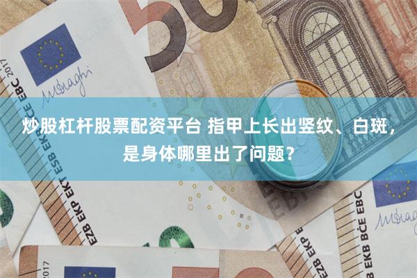炒股杠杆股票配资平台 指甲上长出竖纹、白斑，是身体哪里出了问题？